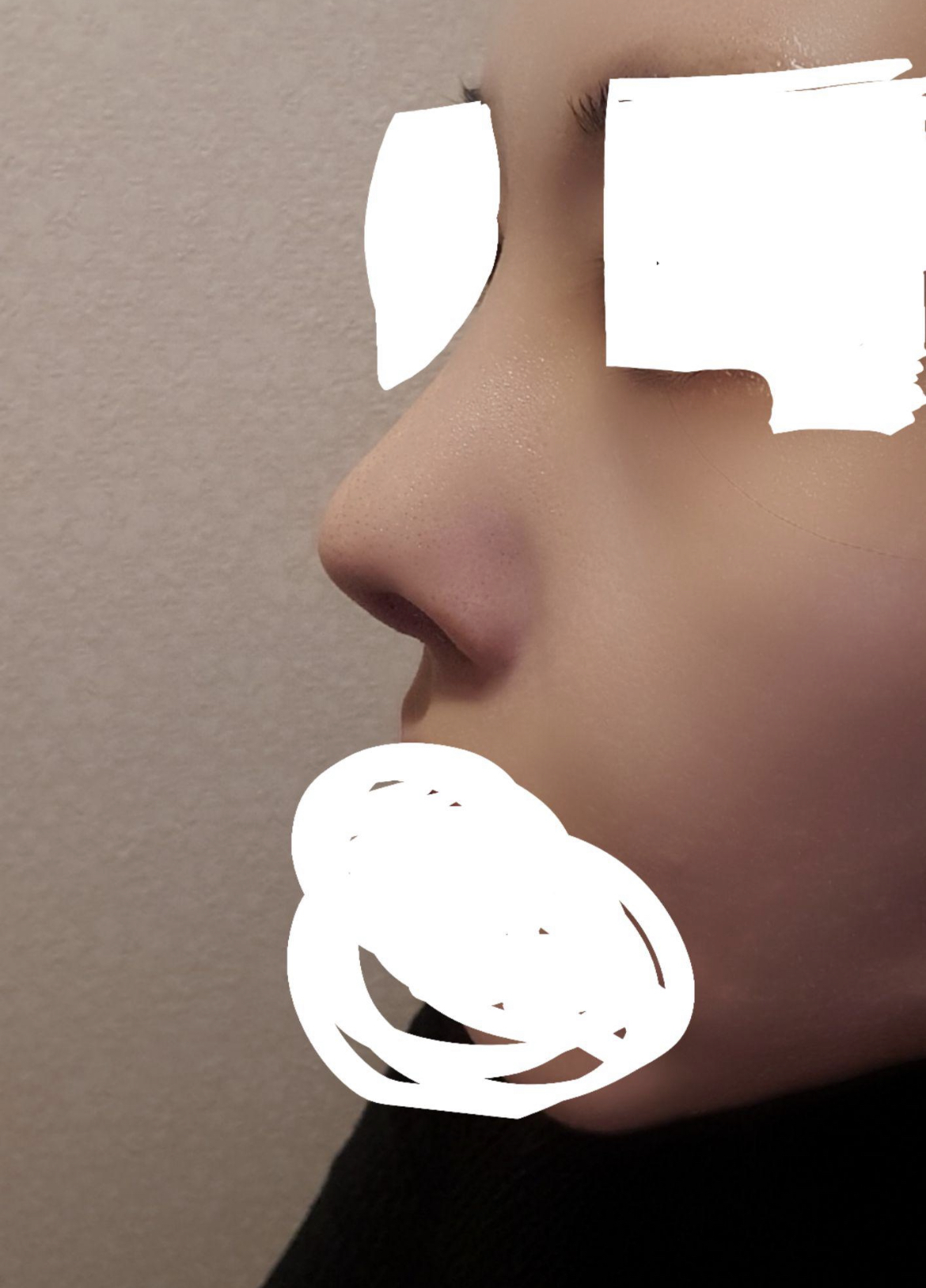 수술후기이미지