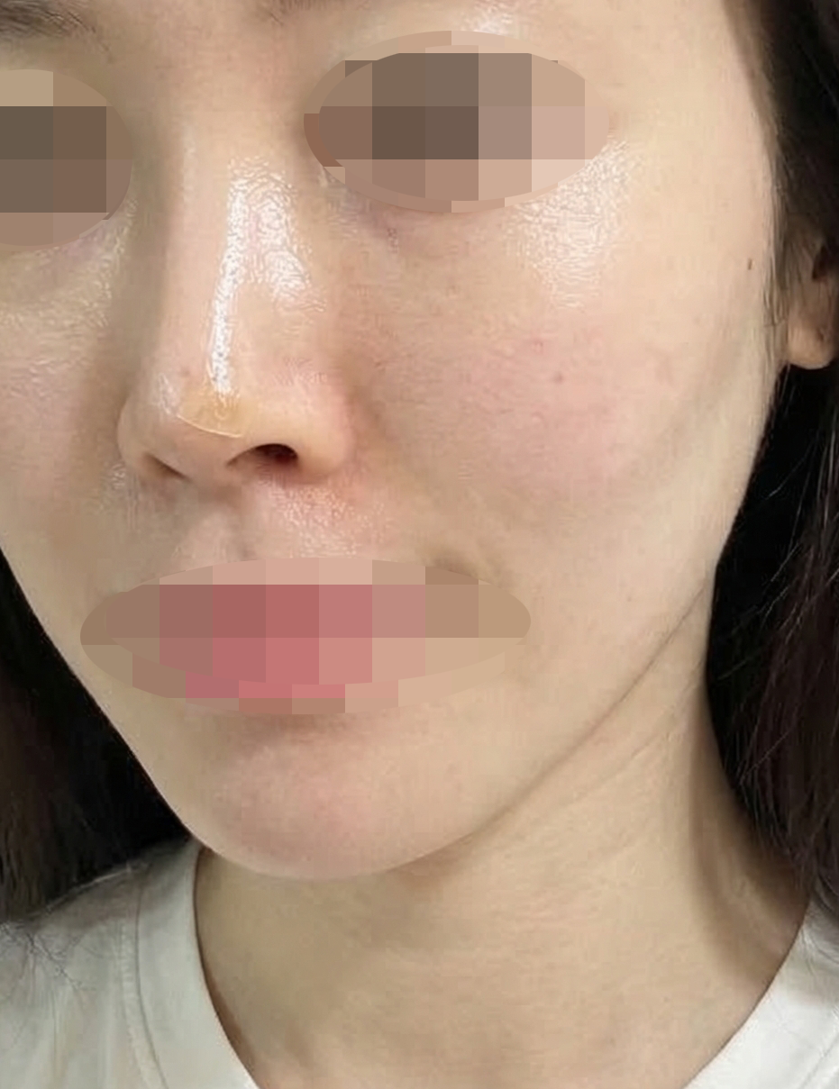 수술후기이미지