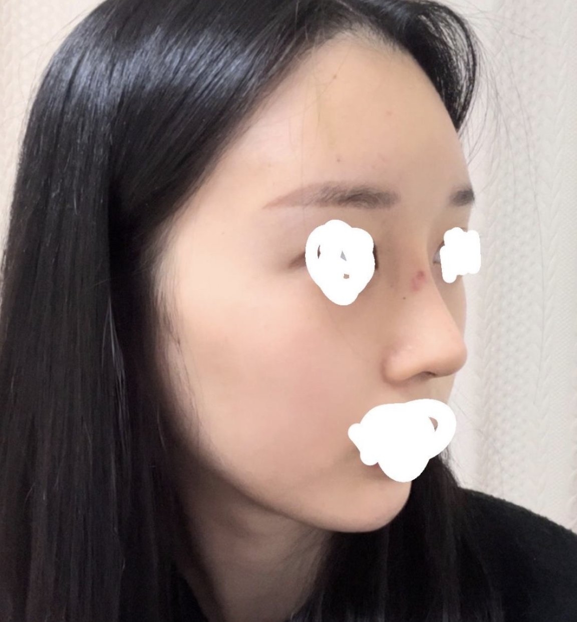 수술후기이미지