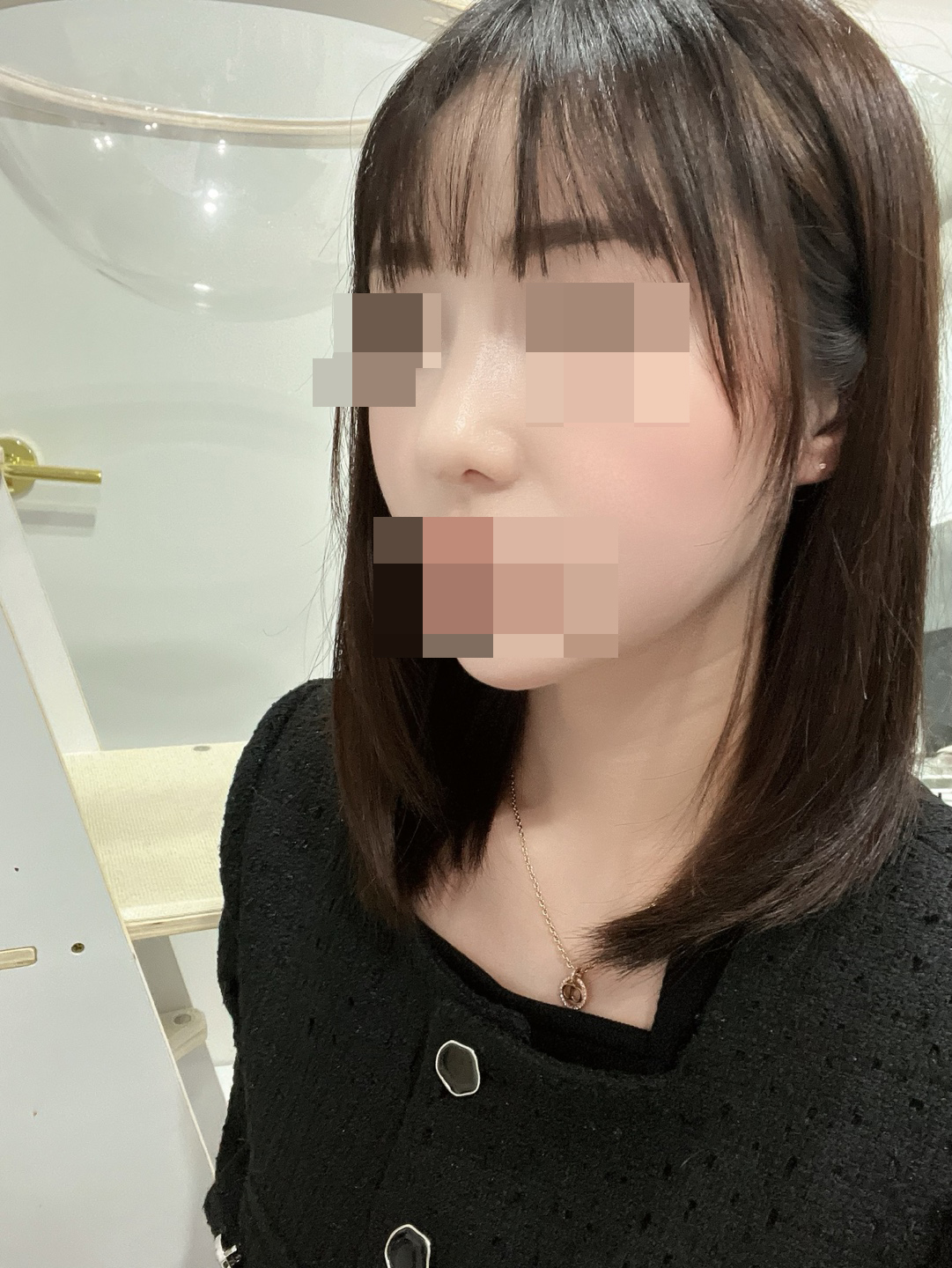 수술후기이미지