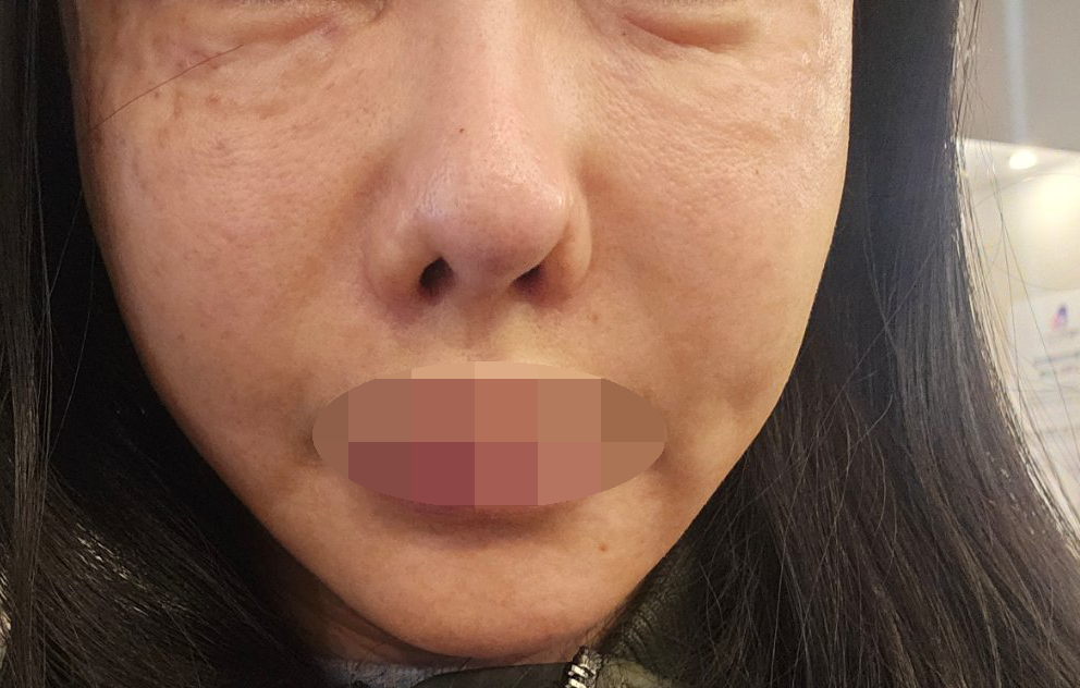 수술후기이미지