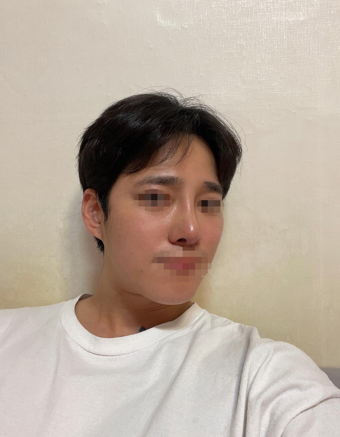 수술후기이미지