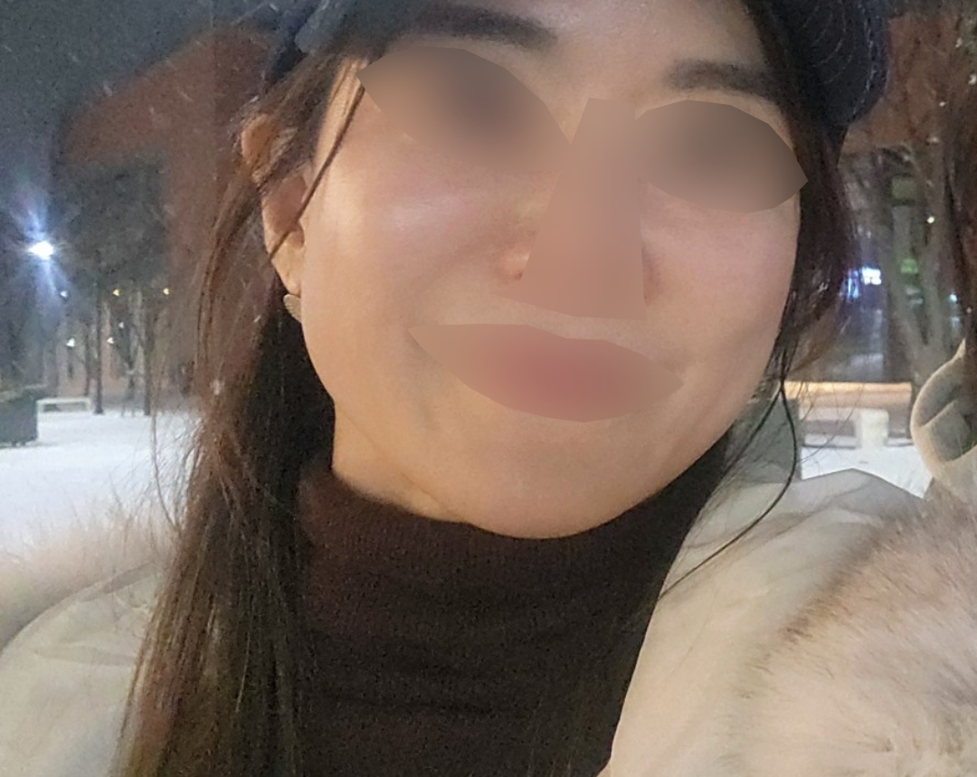 수술후기이미지