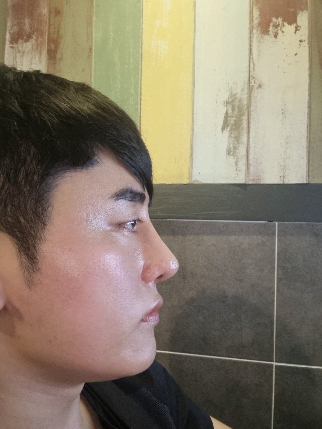 수술후기이미지