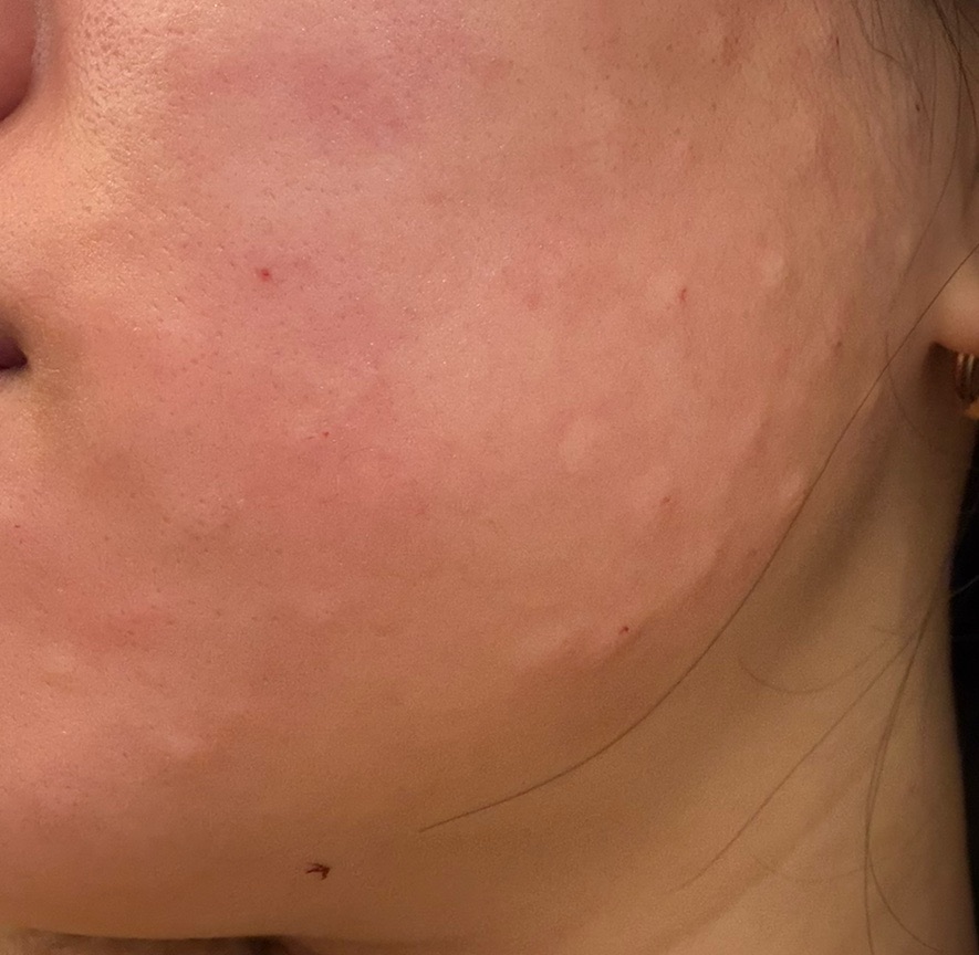 수술후기이미지