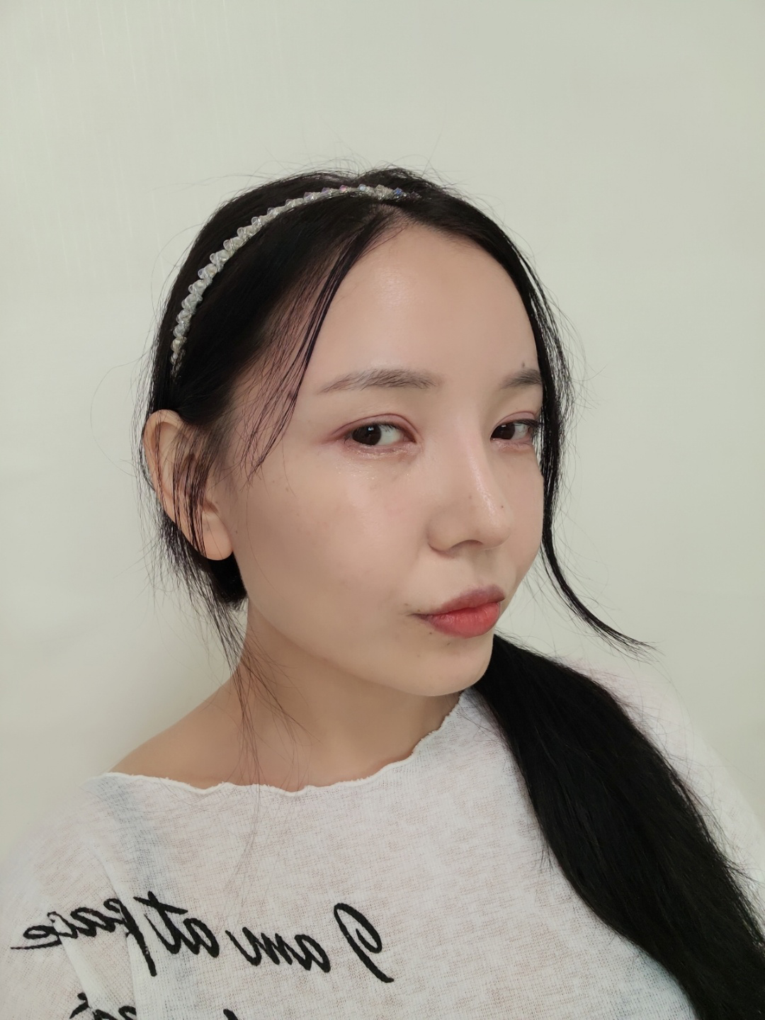 수술후기이미지