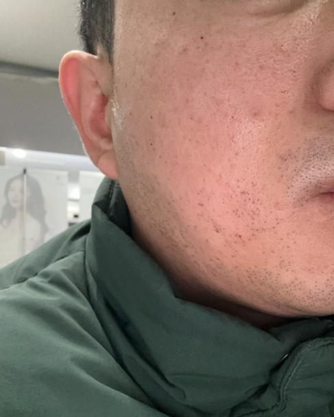 수술후기이미지