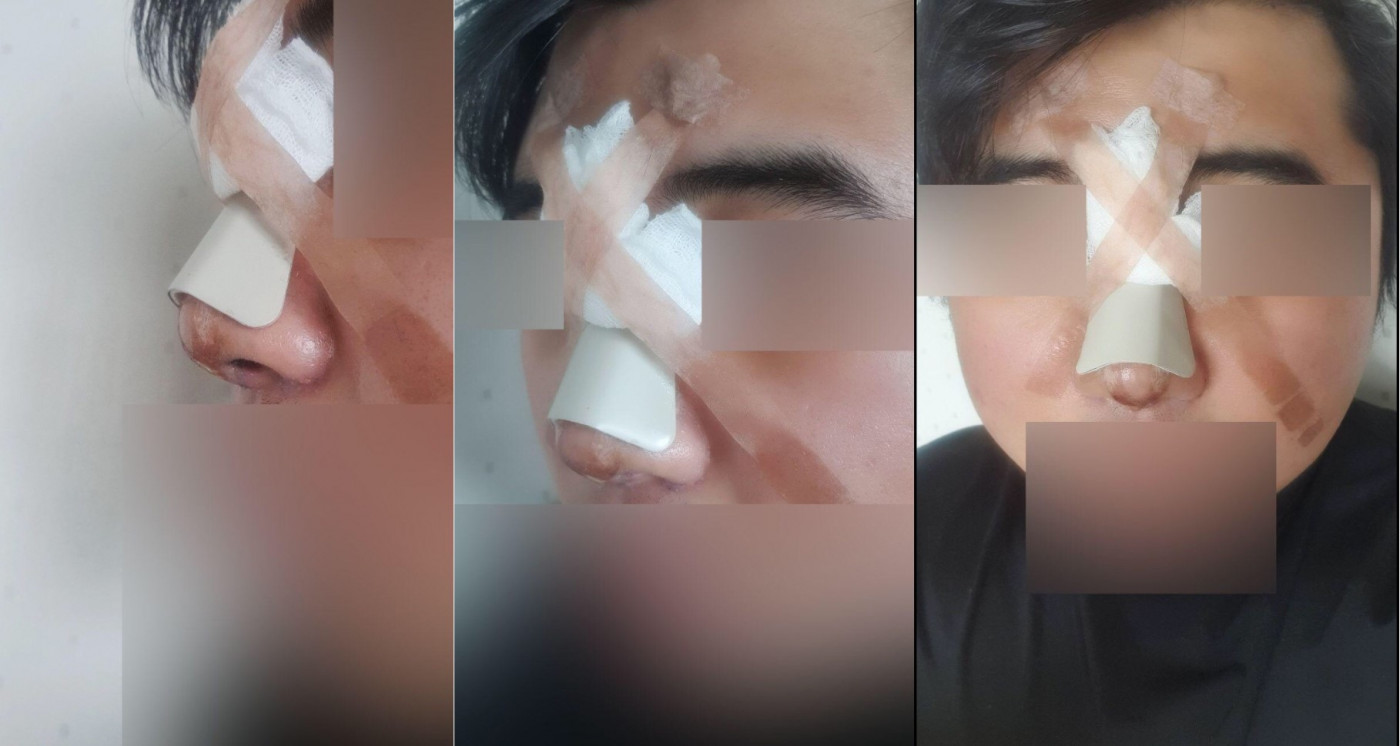 수술후기이미지