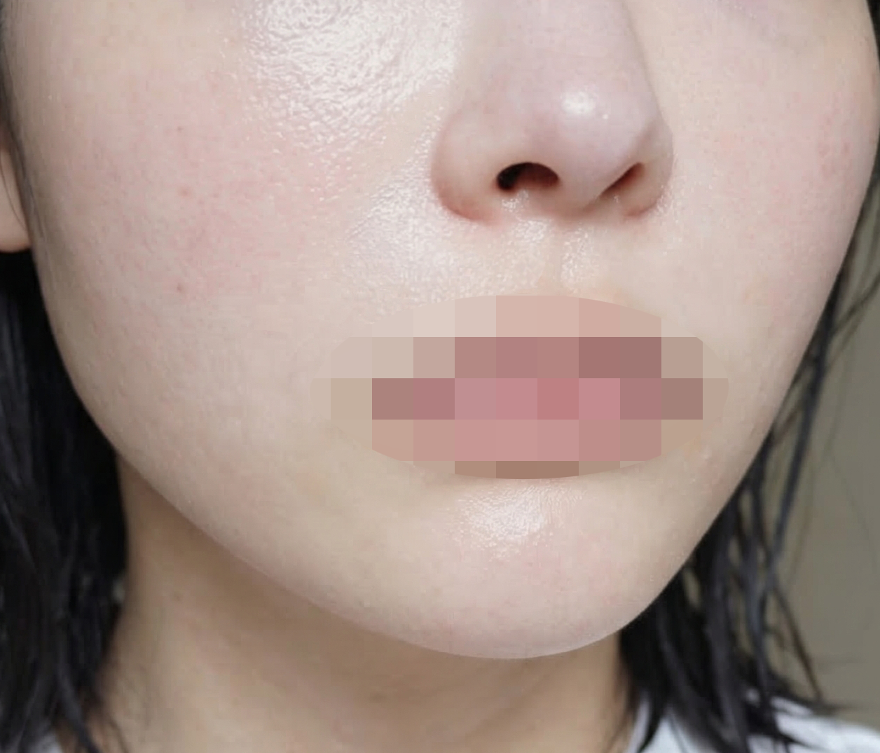 수술후기이미지