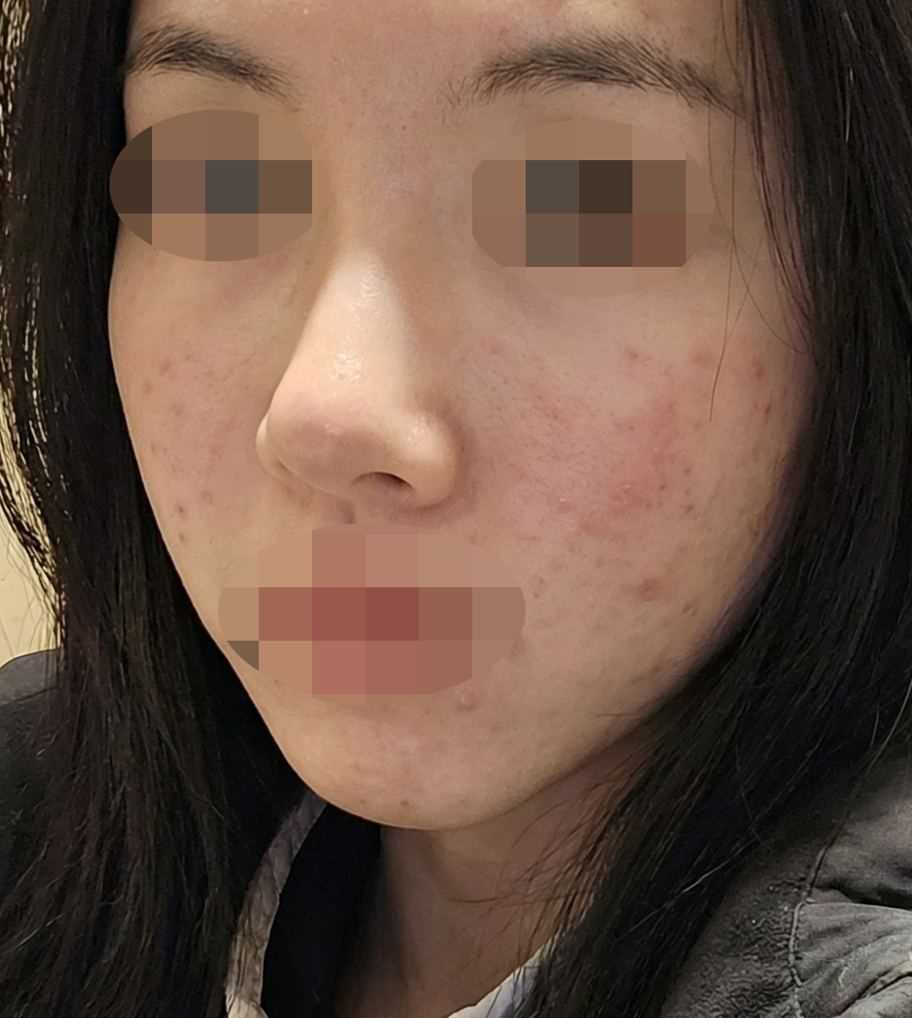 수술후기이미지