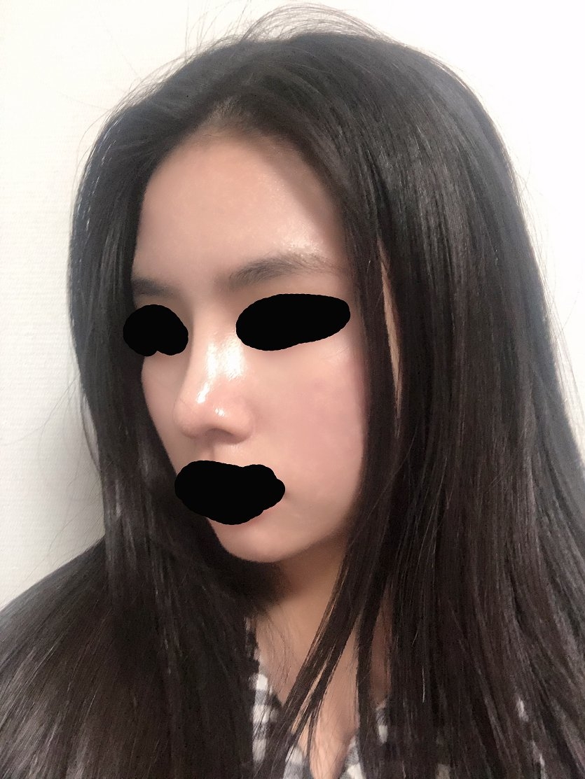 수술후기이미지