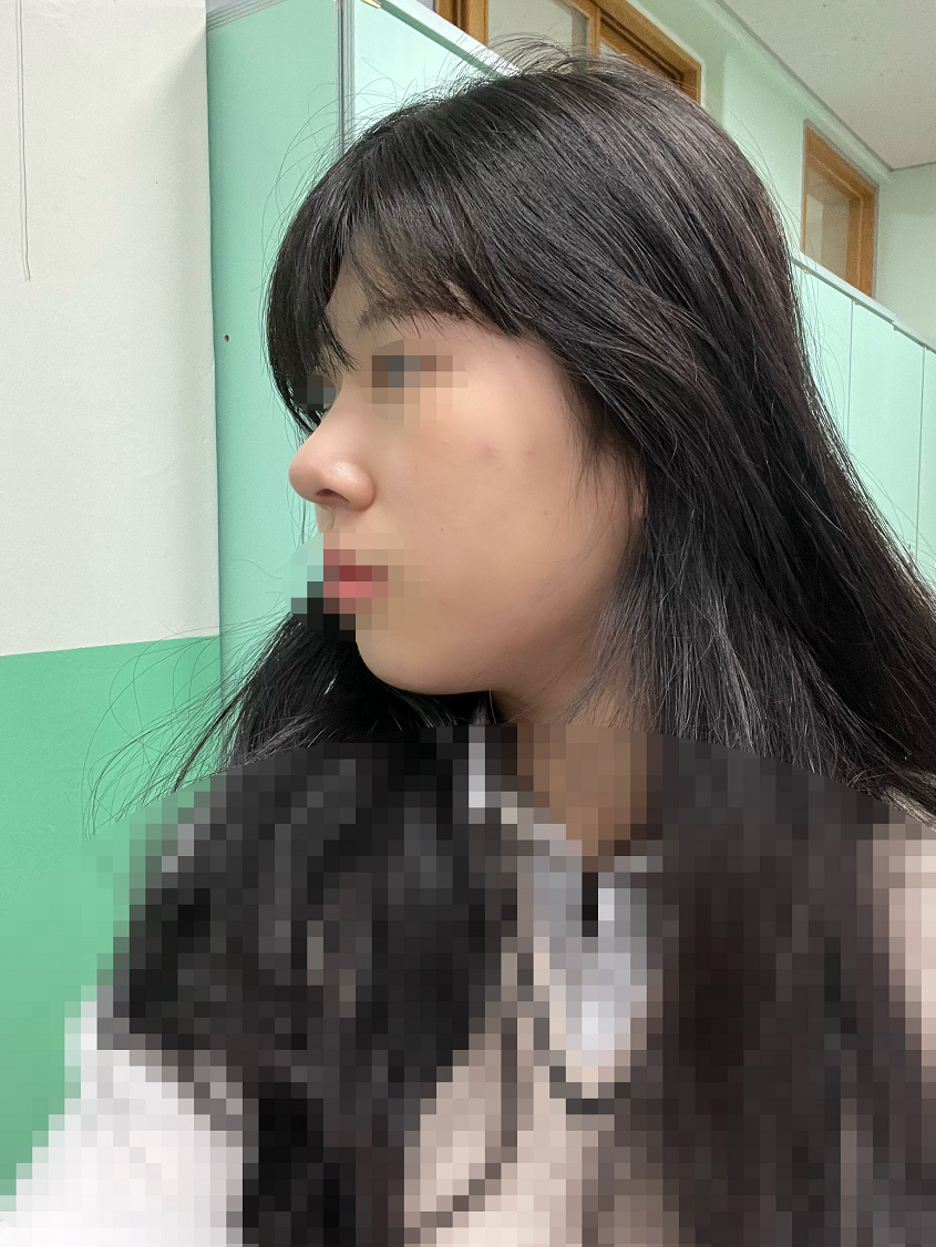 수술후기이미지