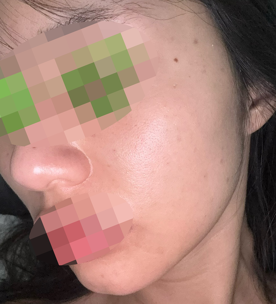 수술후기이미지