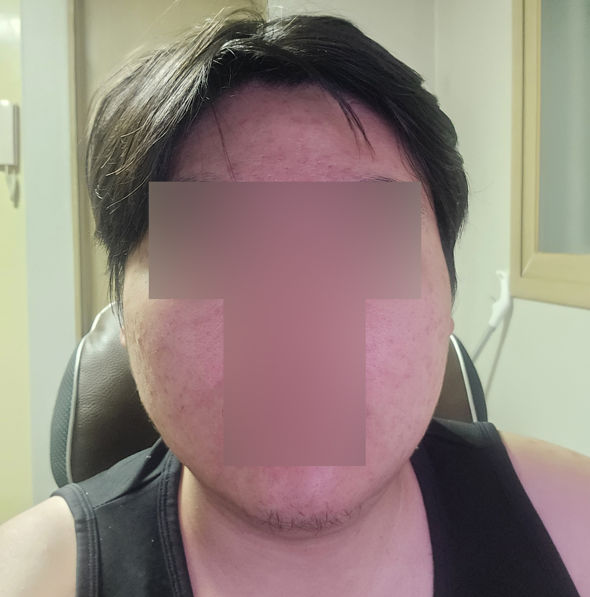 수술후기이미지
