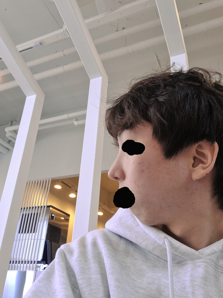 수술후기이미지