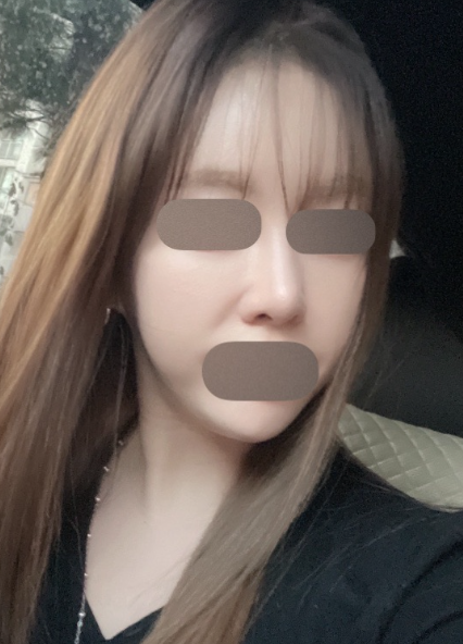 수술후기이미지