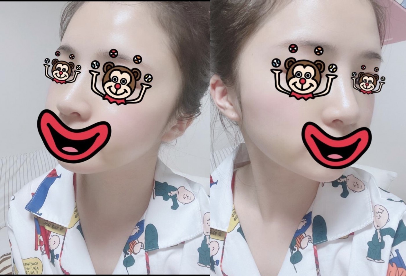 수술후기이미지