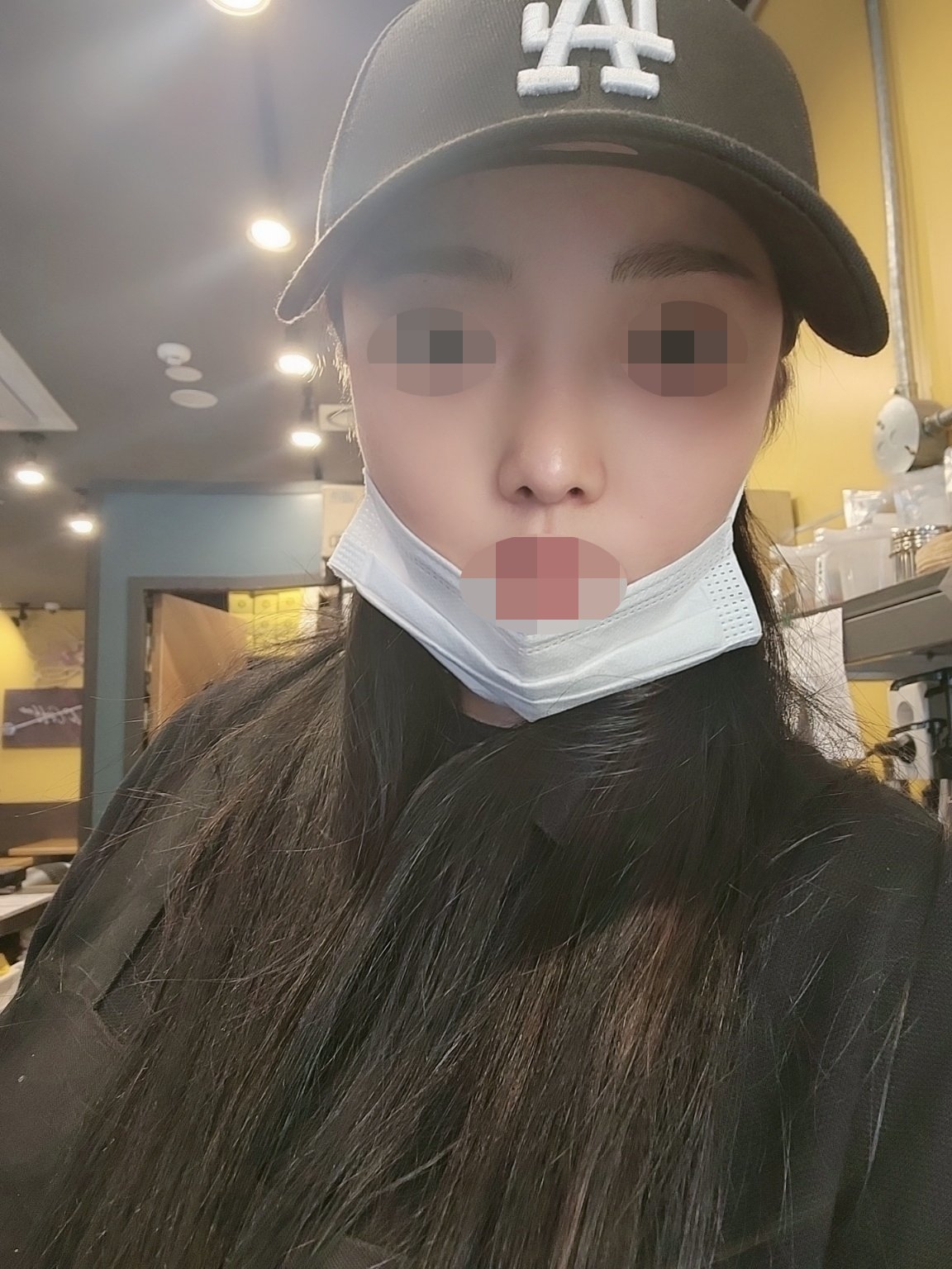 수술후기이미지