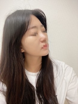 수술후기이미지