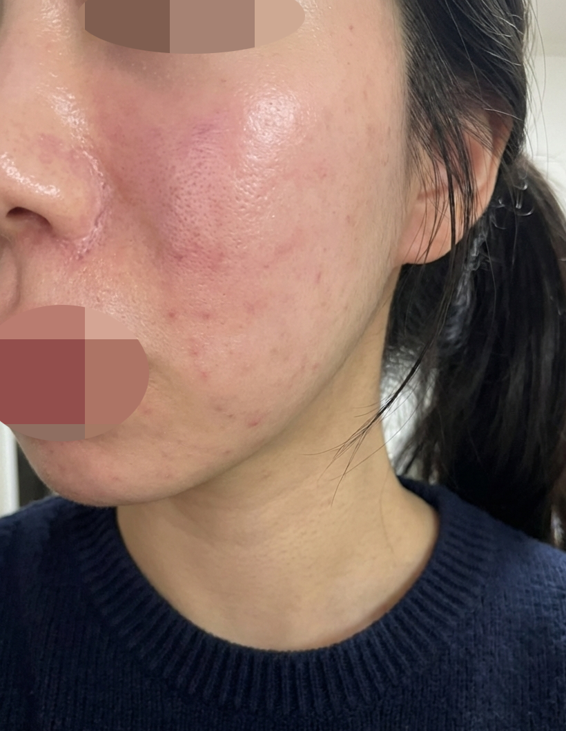 수술후기이미지