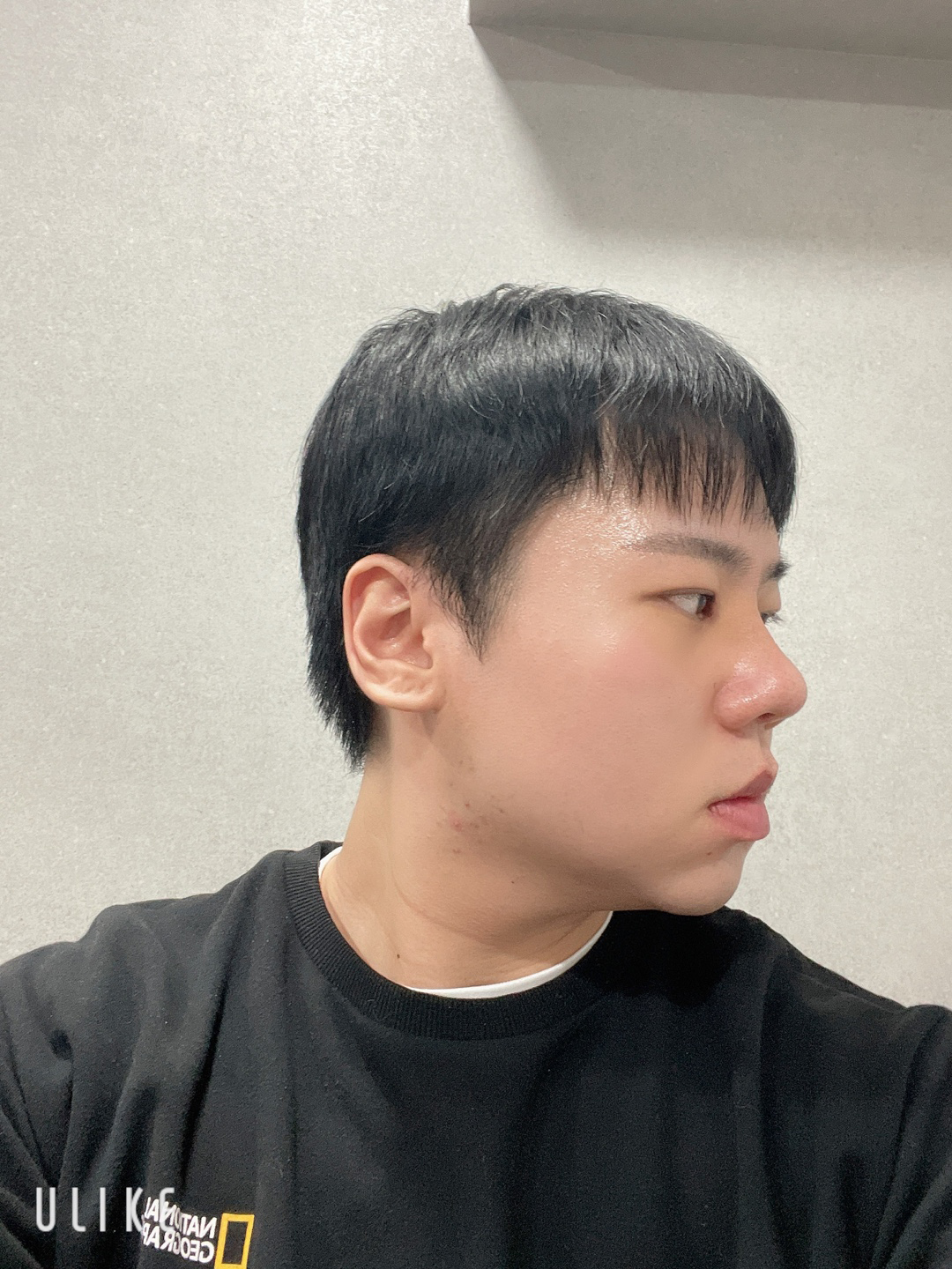 수술후기이미지