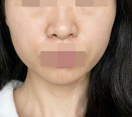 수술후기이미지