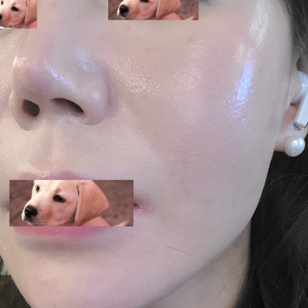 수술후기이미지