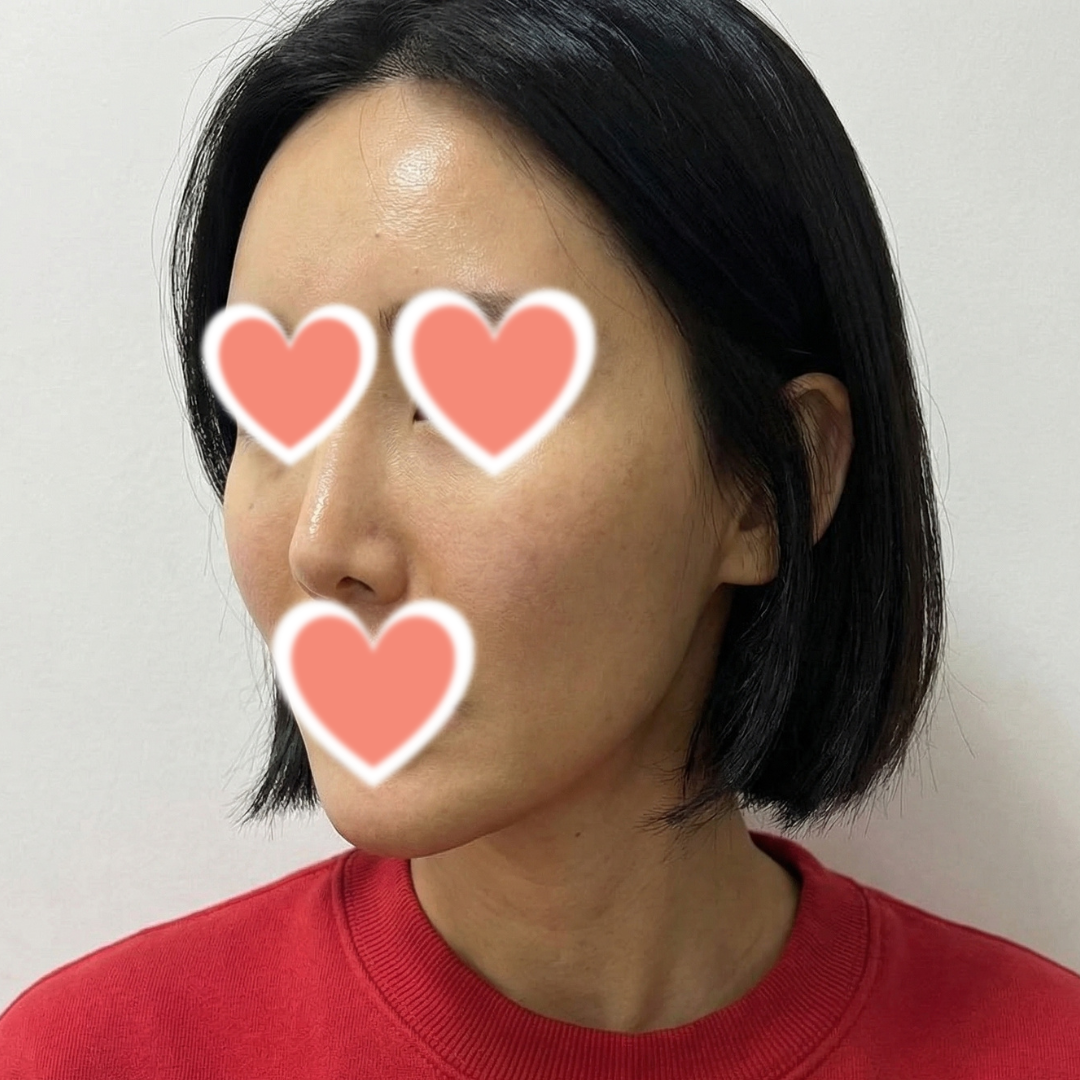 수술후기이미지