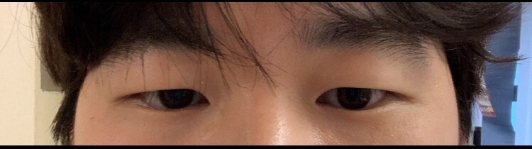 수술후기이미지