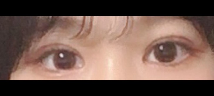 수술후기이미지