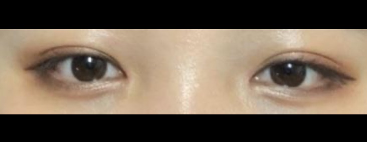 수술후기이미지