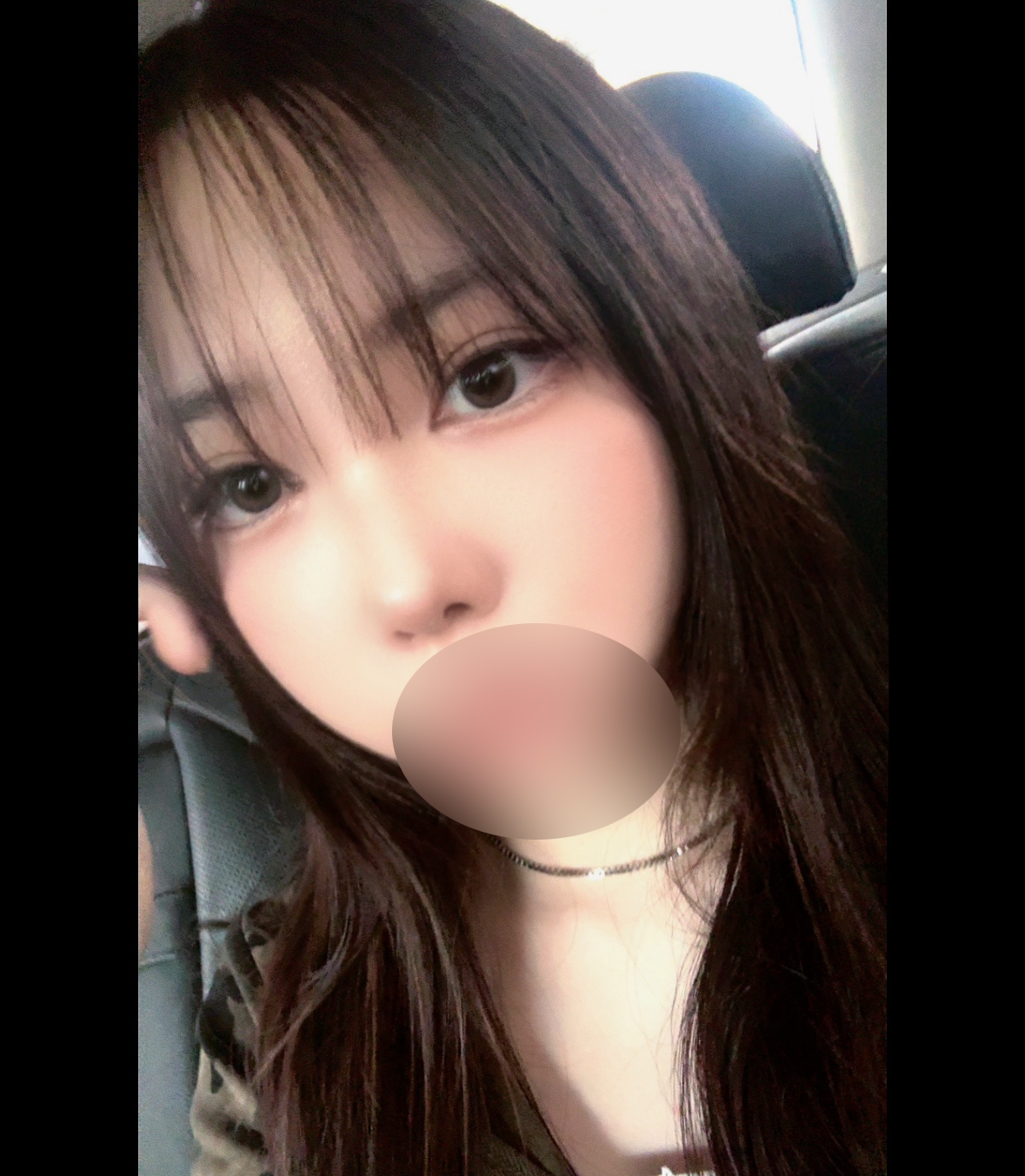 수술후기이미지