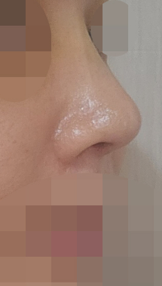 수술후기이미지