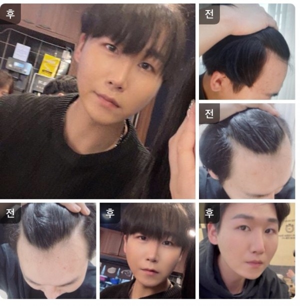 수술후기이미지