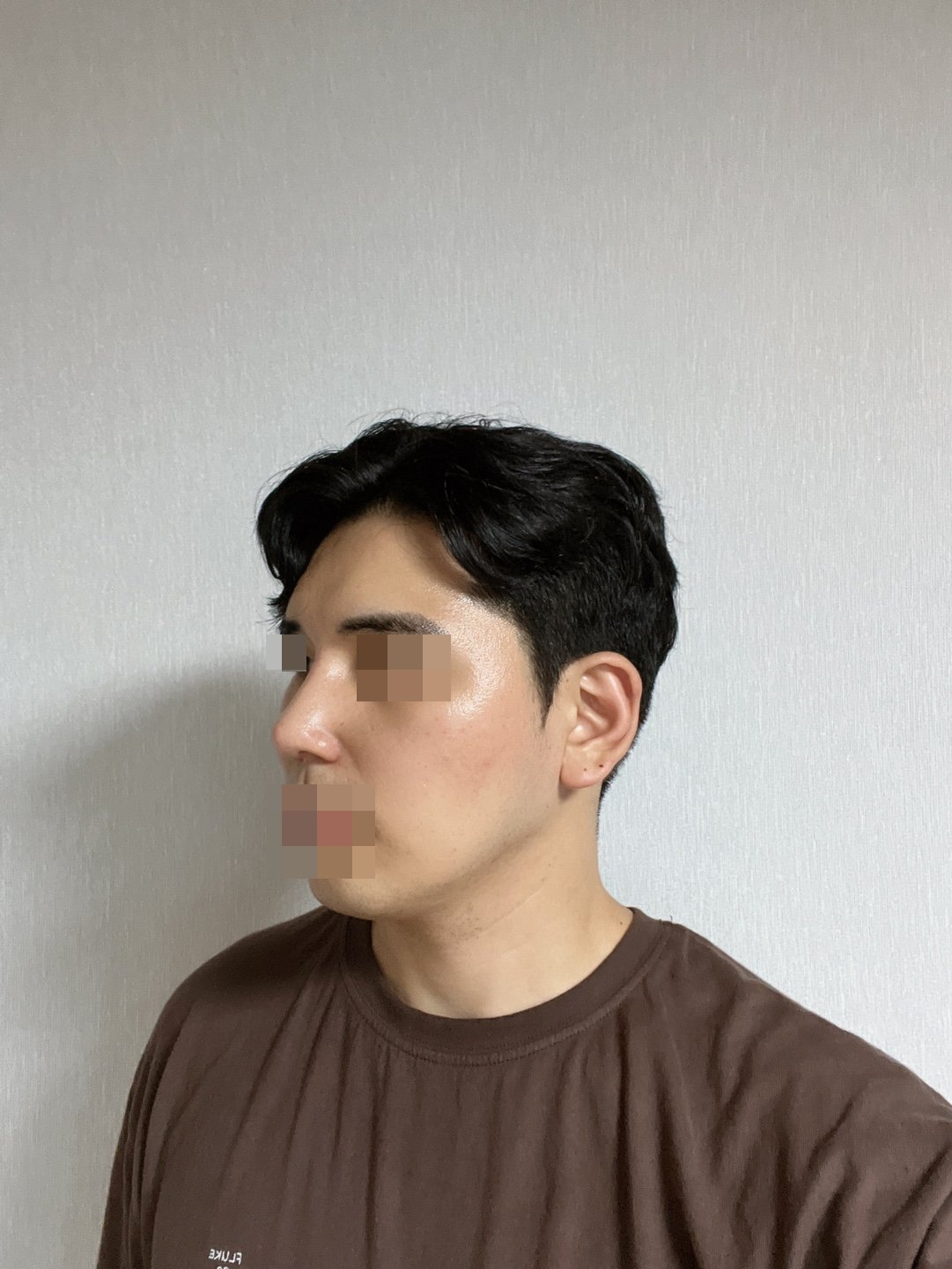 수술후기이미지