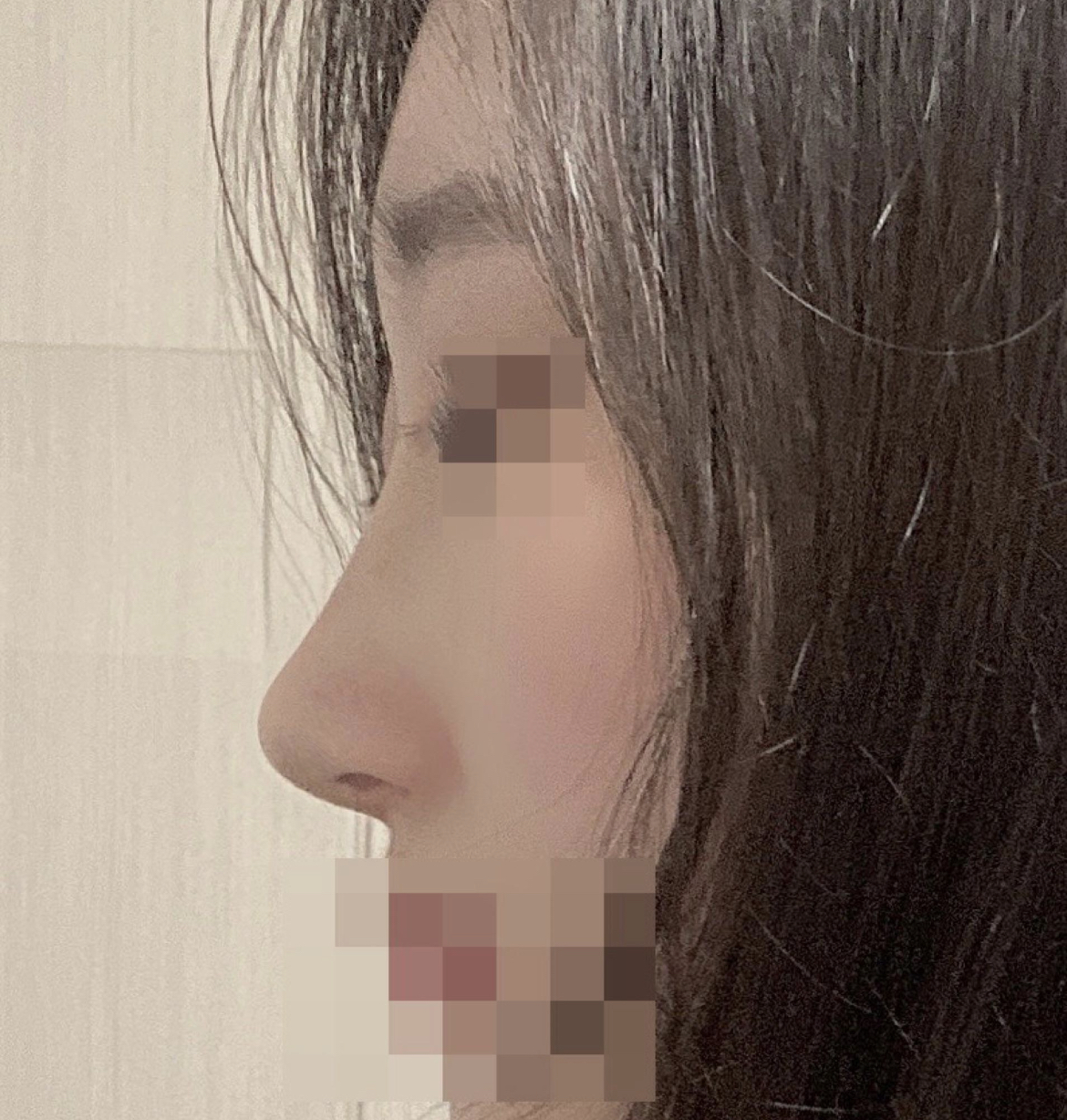 수술후기이미지