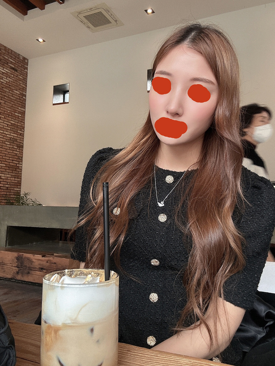 수술후기이미지