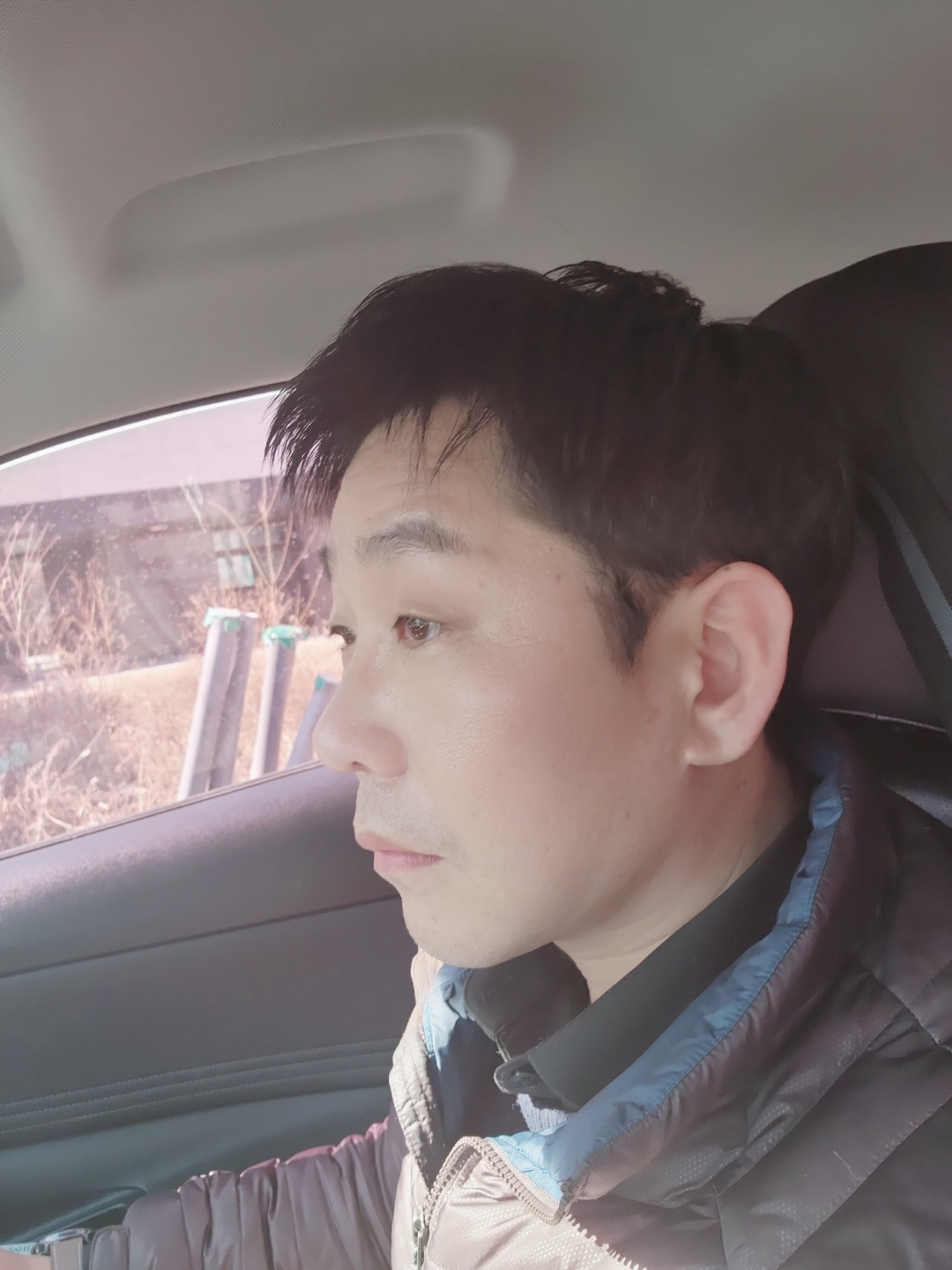 수술후기이미지