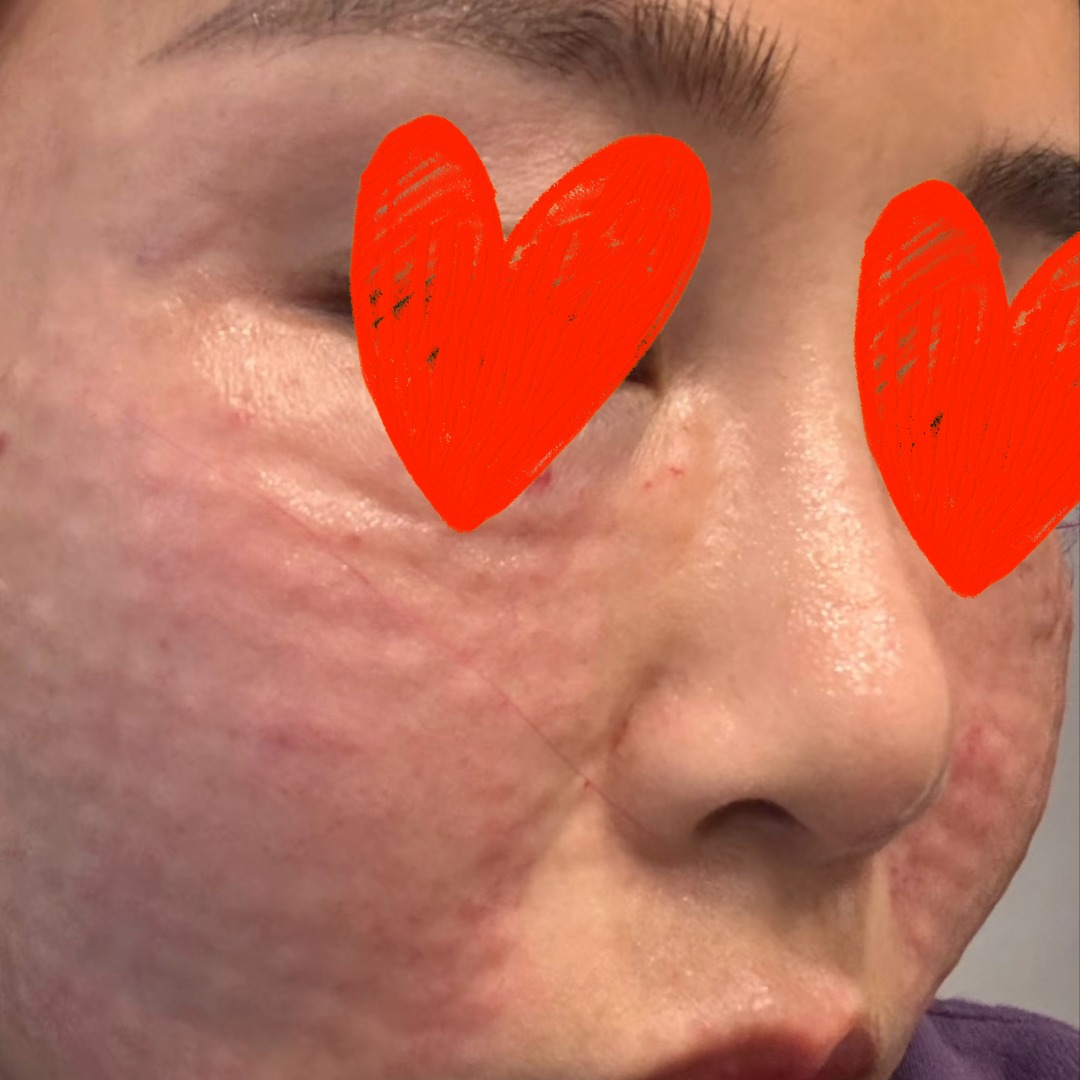 수술후기이미지