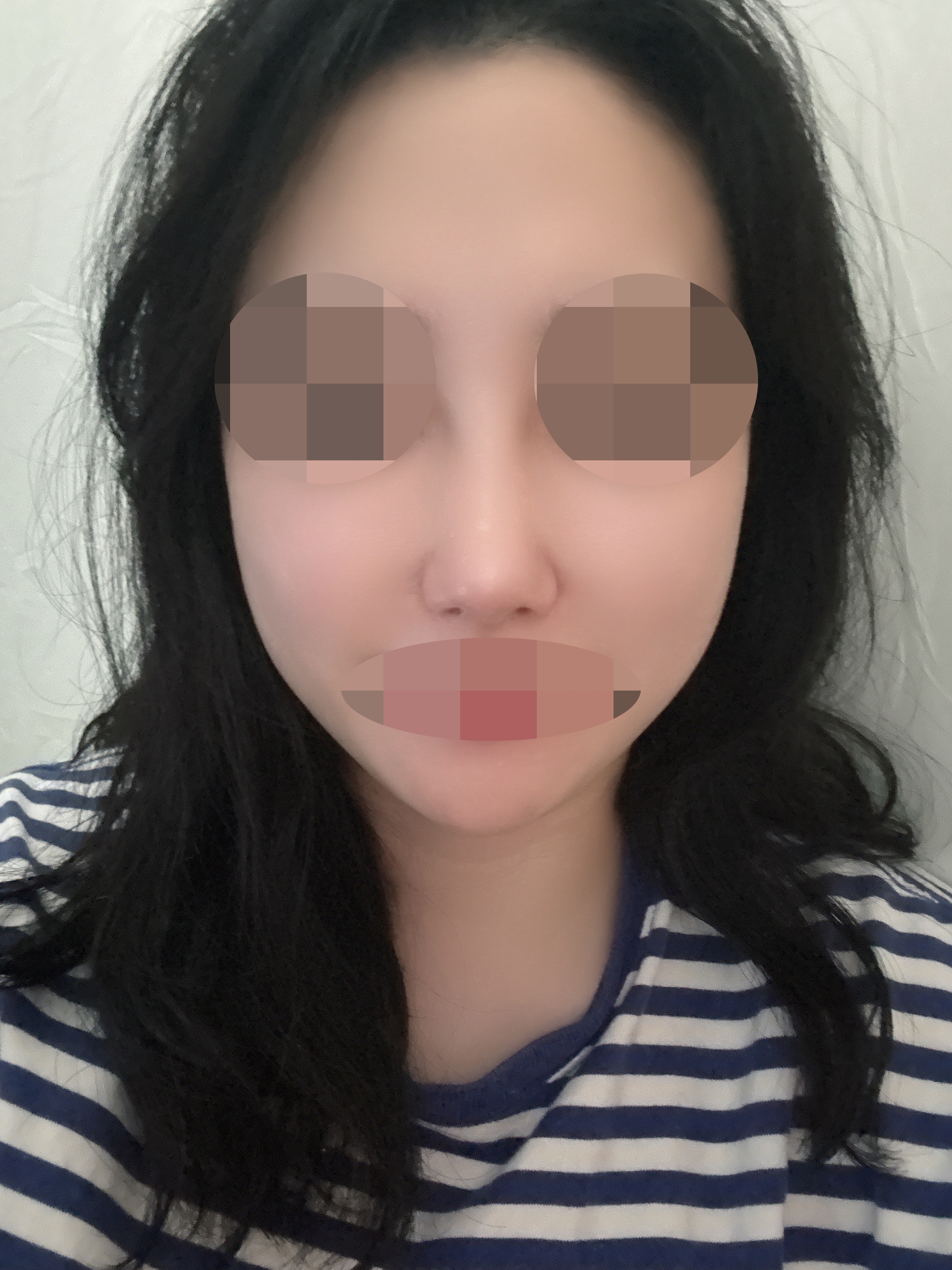 수술후기이미지