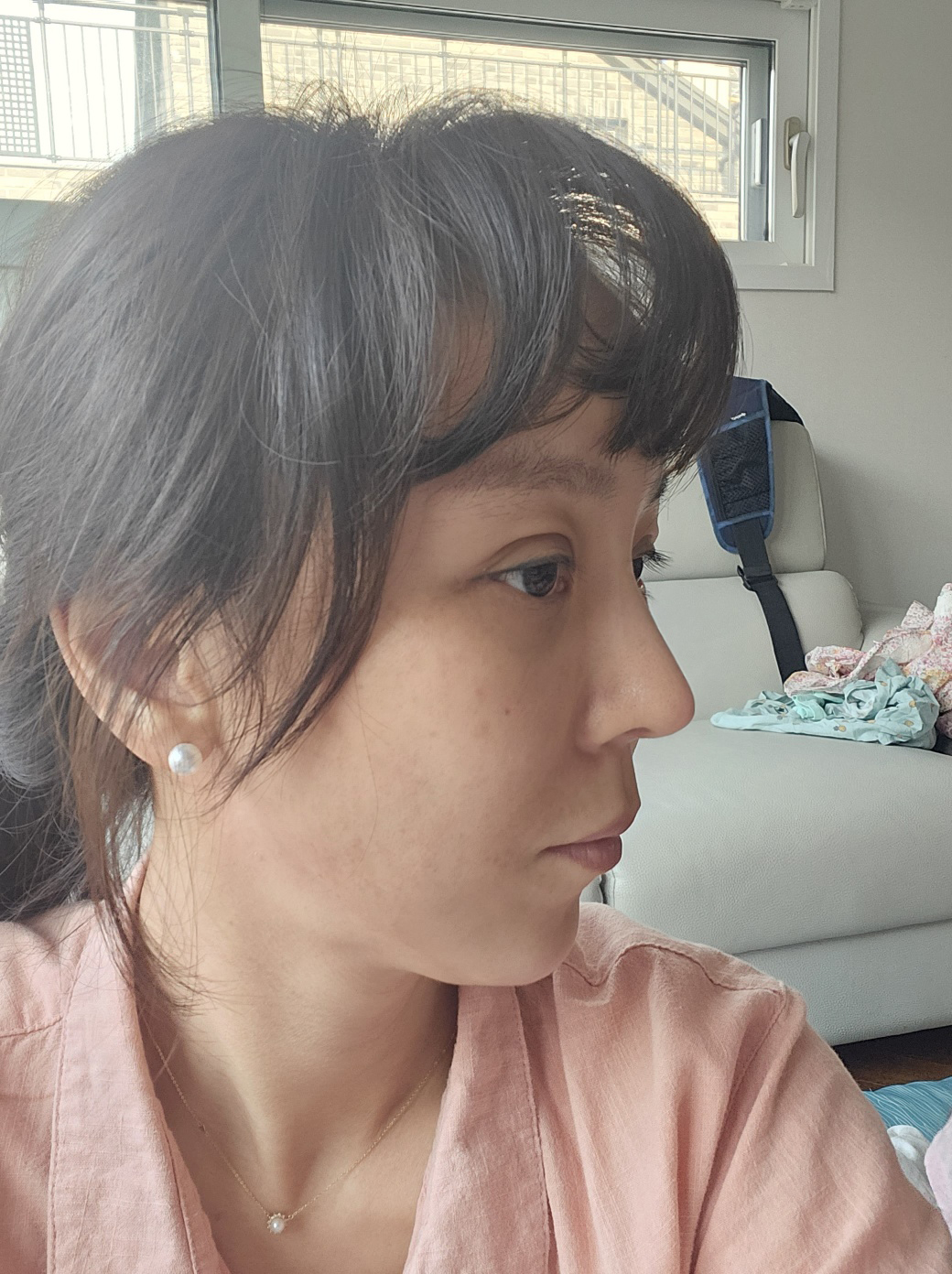 수술후기이미지