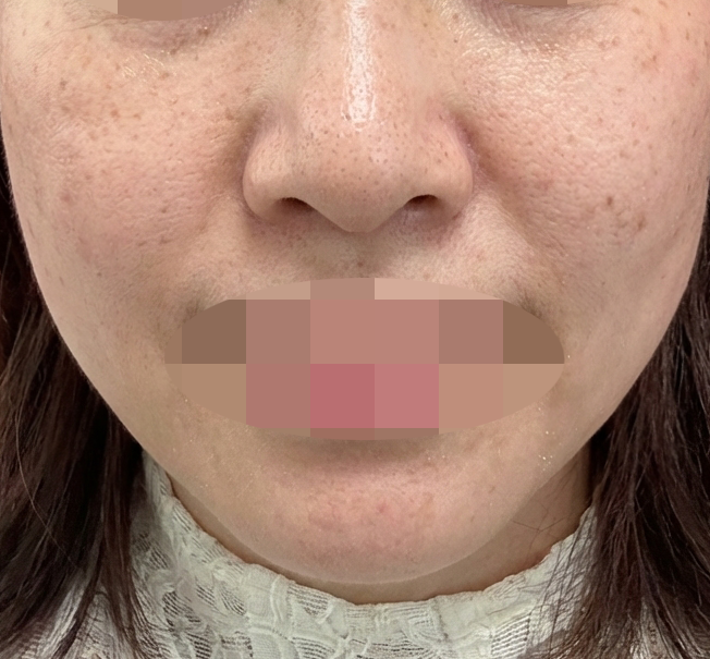 수술후기이미지