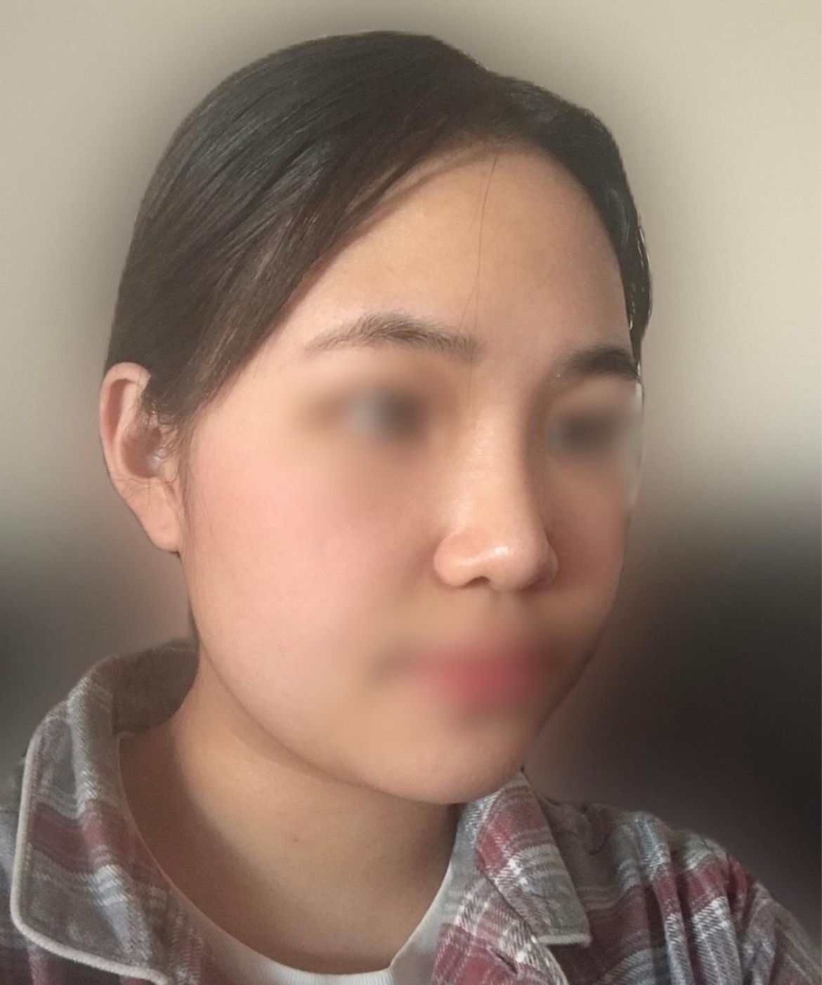 수술후기이미지