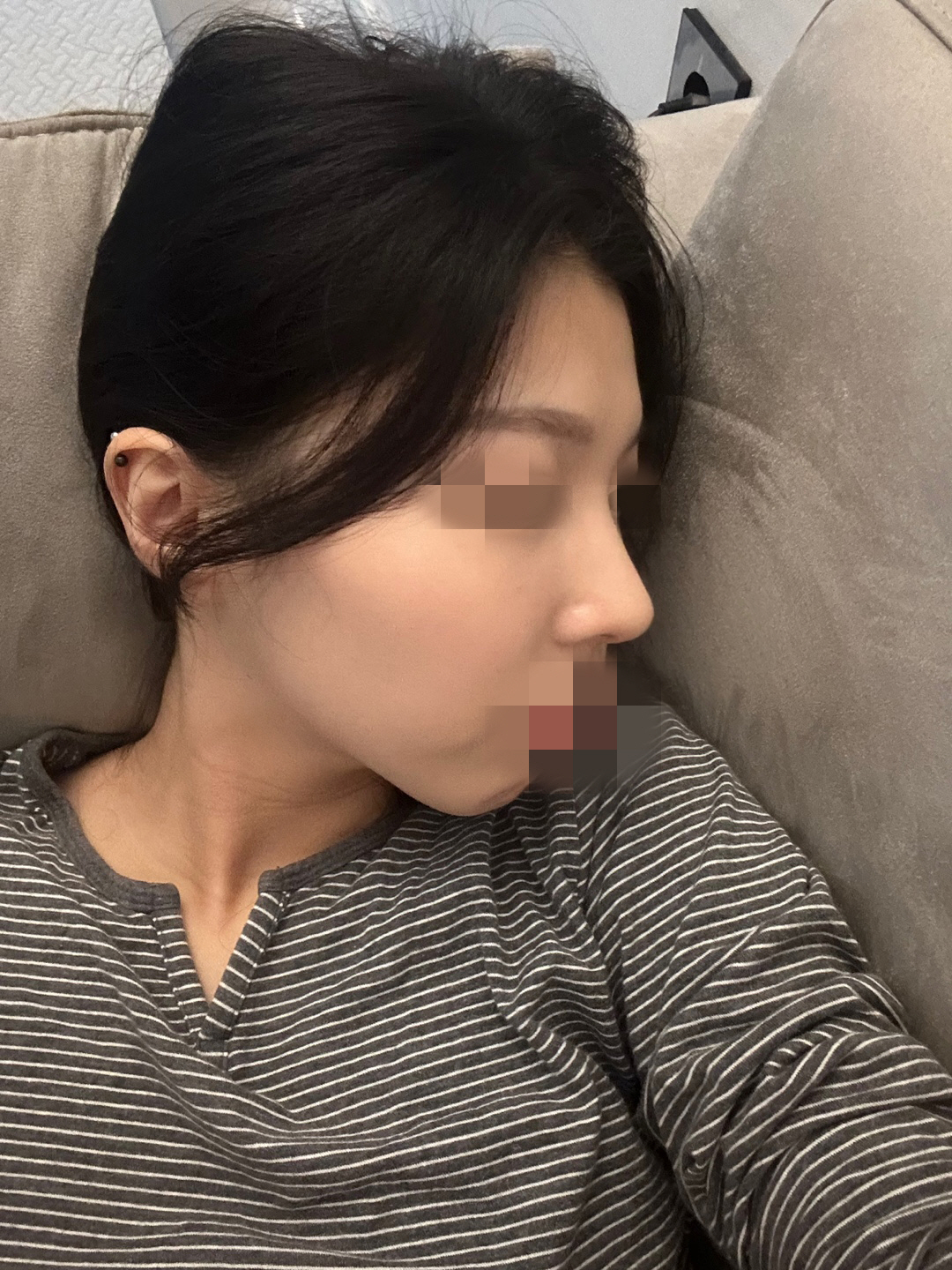 수술후기이미지