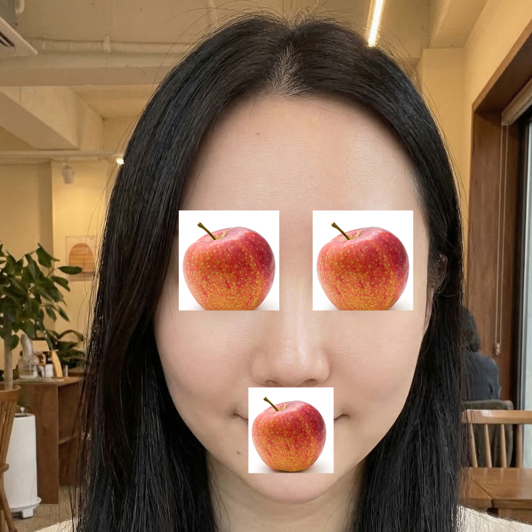 수술후기이미지