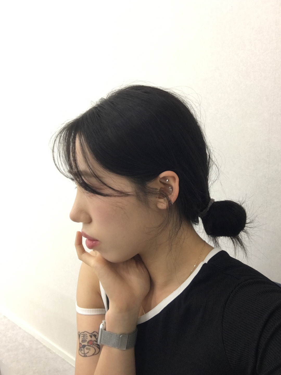 수술후기이미지