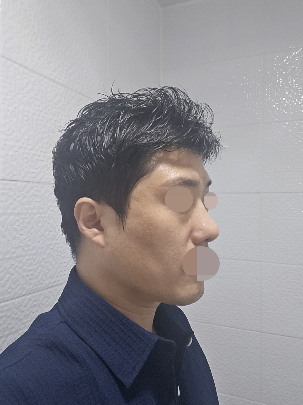 수술후기이미지