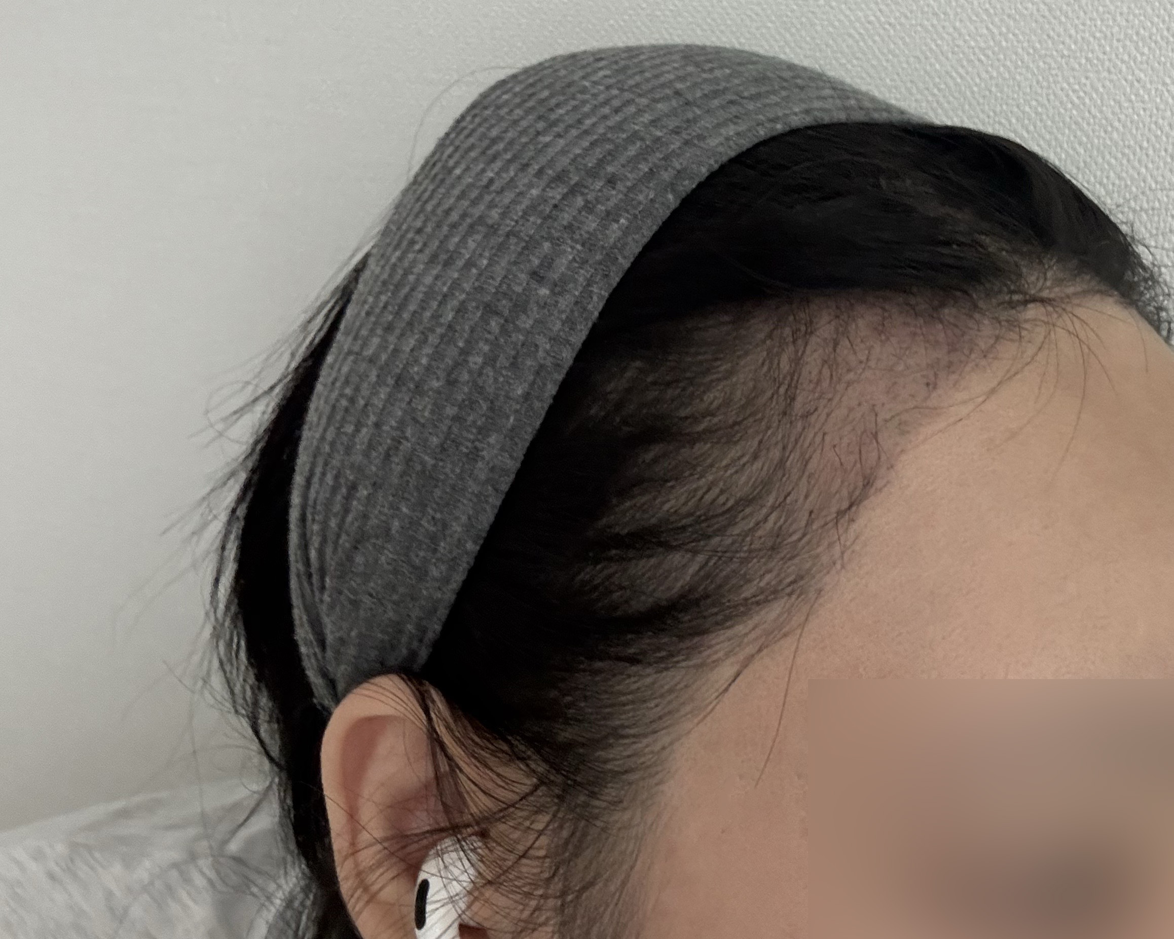 수술후기이미지