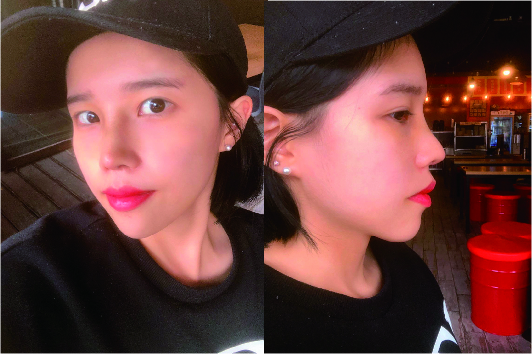 수술후기이미지