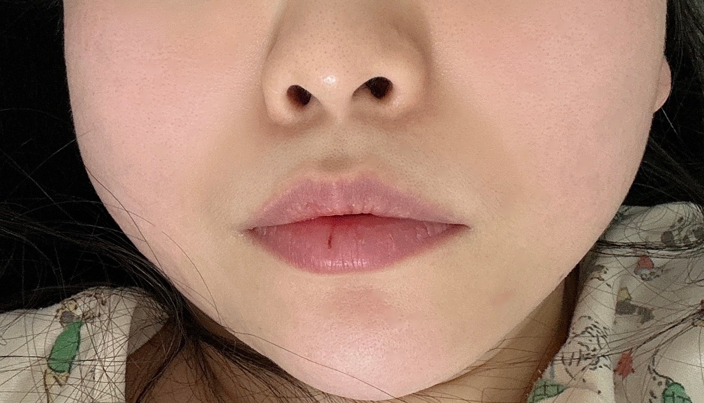 수술후기이미지